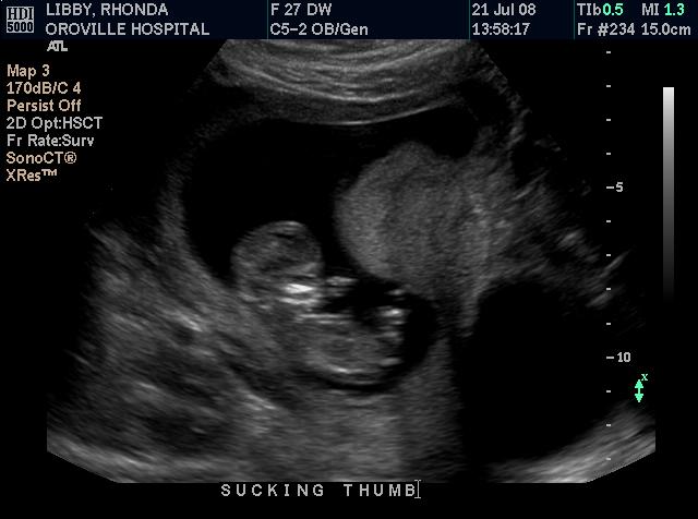 ultrasound1